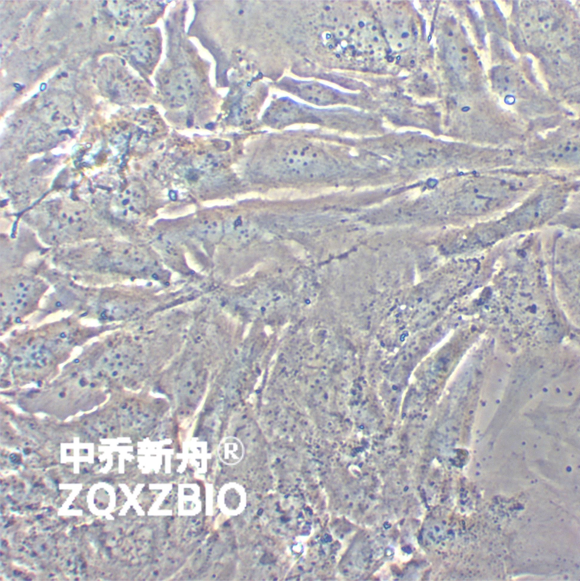 SNU-475人肝癌细胞