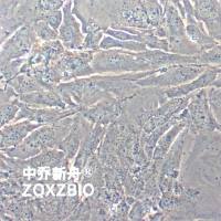 SNU-475人肝癌细胞