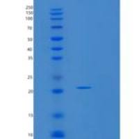 人SMAC/Diablo重组蛋白