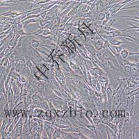 HSF人皮肤成纤维细胞