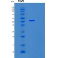 人精胺合酶(SMS)重组蛋白