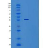 人信号转导衔接蛋白1(STAP1)重组蛋白