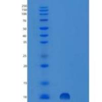人丝氨酸肽酶抑制因子Kazal型7(SPINK7)重组蛋白