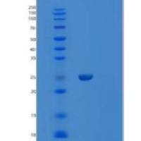 人涎福林蛋白(SPN)重组蛋白