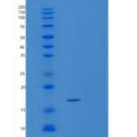 人SRP19重组蛋白
