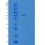 人沉默调节蛋白6(SIRT6)重组蛋白