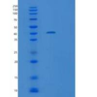 人沉默调节蛋白6(SIRT6)重组蛋白