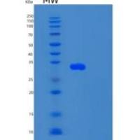 人单链选择性单功能尿嘧啶DNA糖基化酶1(SMUG1)重组蛋白