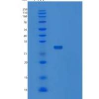 人突触融合蛋白12(STX12)重组蛋白