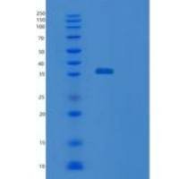 人Stomatin样蛋白1(STOML1)重组蛋白