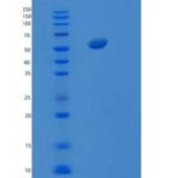 大肠杆菌丝氨酰tRNA合成酶重组蛋白