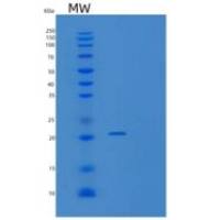 人CD27结合蛋白(CD27BP)重组蛋白