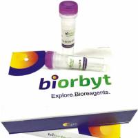 Antigen analysis, Pre-screening, Immunization and Boosters 蛋白，orb1787796，Biorbyt