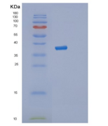 人丝氨酸/苏氨酸激酶3(STK3)重组蛋白