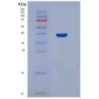 人STBD1重组蛋白