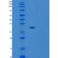 人SUGT1重组蛋白