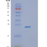 人ZNRD2 (SSSCA1)重组蛋白产品图