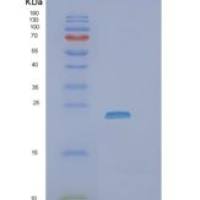 人ZNRD2 (SSSCA1)重组蛋白