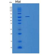 人含侧支发芽因子相关EVH1域蛋白1(SPRED1)重组蛋白