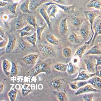 Hcc1806人乳腺癌细胞