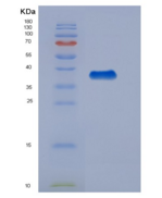 人突触融合蛋白11(STX11)重组蛋白