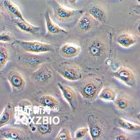 HSC-2人口腔鳞状肿瘤细胞