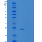 人胞浆磷蛋白3(STMN3)重组蛋白