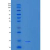 小鼠突触核蛋白α(SNCa)重组蛋白重组蛋白