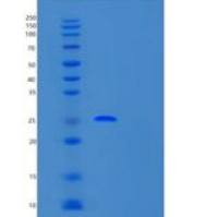 人25kDa突触关联蛋白(SNAP25)重组蛋白