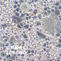 CAMA-1人乳腺腺癌细胞