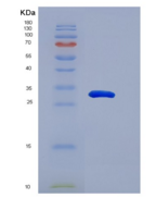 人Snail同源物1(SNAI1)重组蛋白