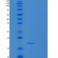 人S-期激酶关联蛋白1(SKP1)重组蛋白