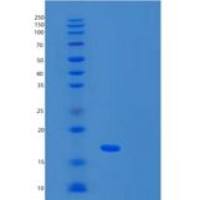 人SNRNP25重组蛋白