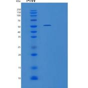 人含侧支发芽因子相关EVH1域蛋白1(SPRED1)重组蛋白