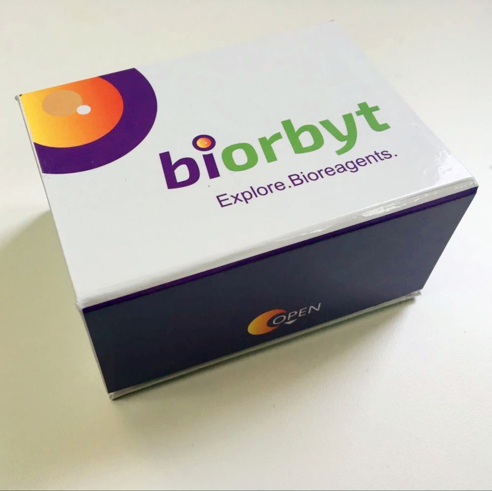 Human BDNF(Brain Derived Neurotrophic Factor) ELISA Kit 酶联免疫试剂盒，orb1807666，Biorbyt