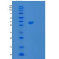 人SPG21重组蛋白