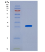 人线粒体超氧化物歧化酶(SOD2)重组蛋白