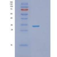 人突触融合蛋白6(STX6)重组蛋白