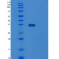 人侧支发芽因子同源物4(SPRY4)重组蛋白