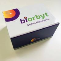 Colloidal Iron Stain Kit 试剂盒，orb1711243，Biorbyt