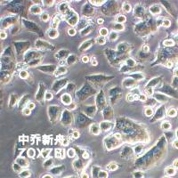 NCI-H1944人肺癌细胞