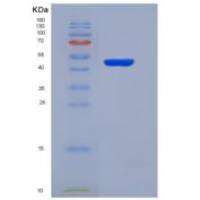 人丝氨酸肽酶抑制因子Kunitz型2(SPINT2)重组蛋白