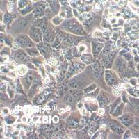 HuTu-80人十二指肠腺癌细胞