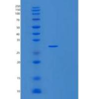 人SNRPA1重组蛋白