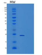 人胞浆磷蛋白3(STMN3)重组蛋白