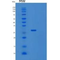 人细胞因子信号转导抑制因子3(SOCS3)重组蛋白