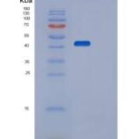 人丝氨酸/苏氨酸蛋白激酶17B（STK17B）重组蛋白