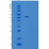 人ST3GAL5重组蛋白