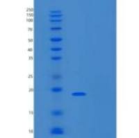 人SNIP1重组蛋白