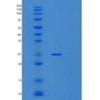 人SMARCA4重组蛋白
